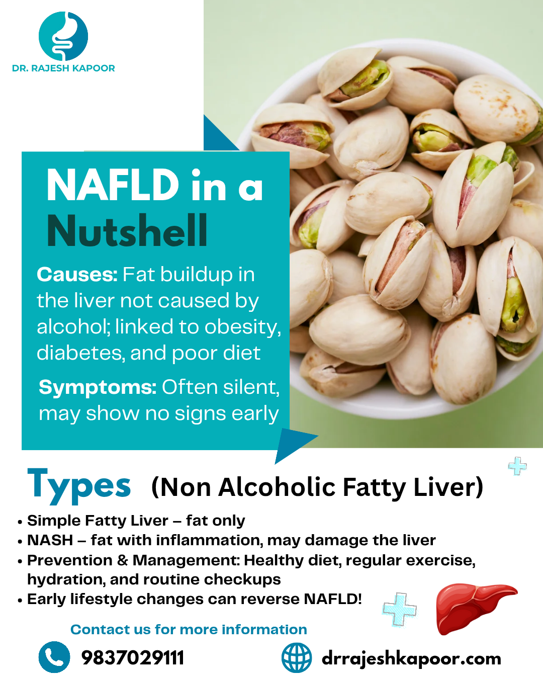 What Is Non-Alcoholic Fatty Liver Disease (NAFLD) & How to Manage It