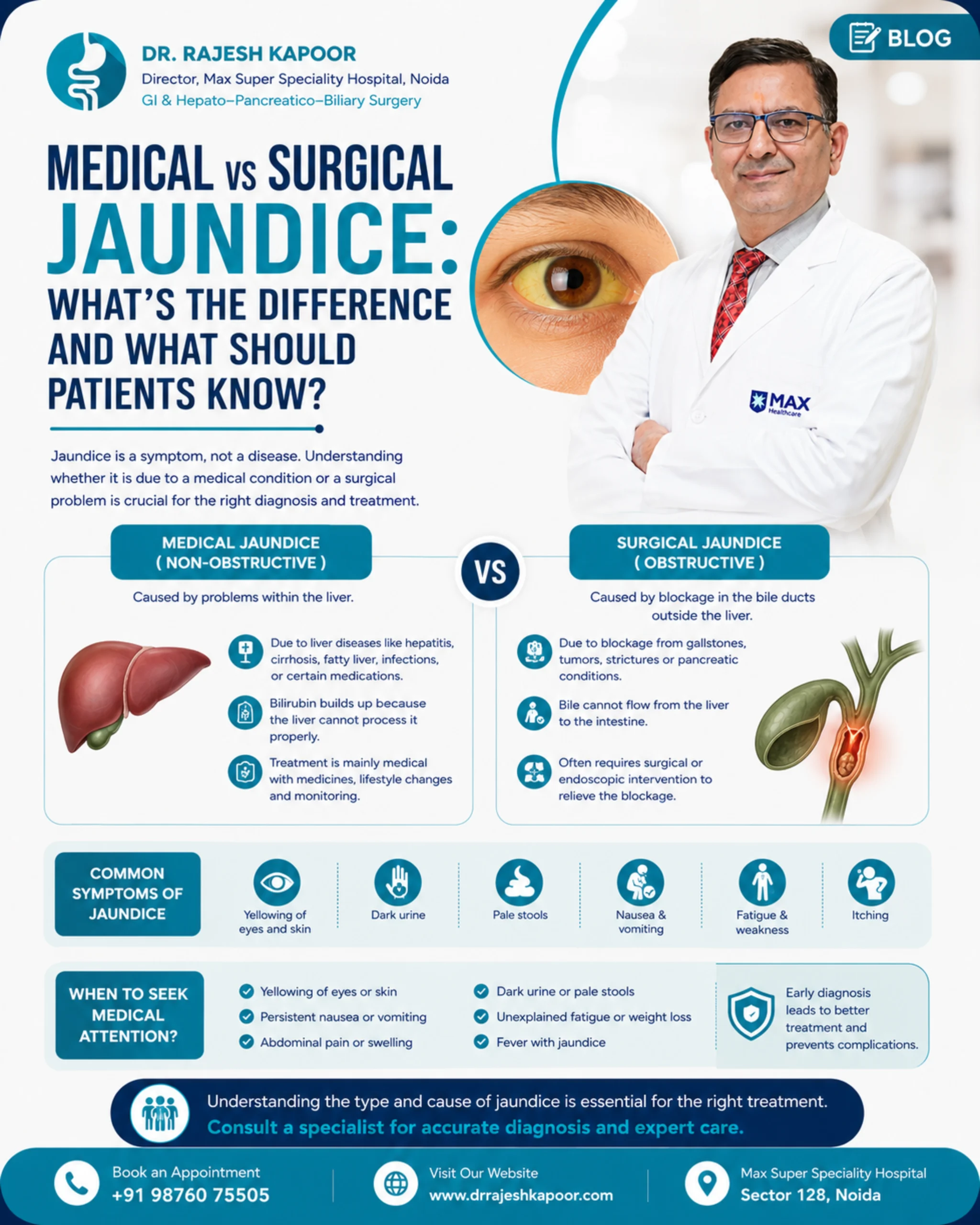 Medical vs Surgical Jaundice