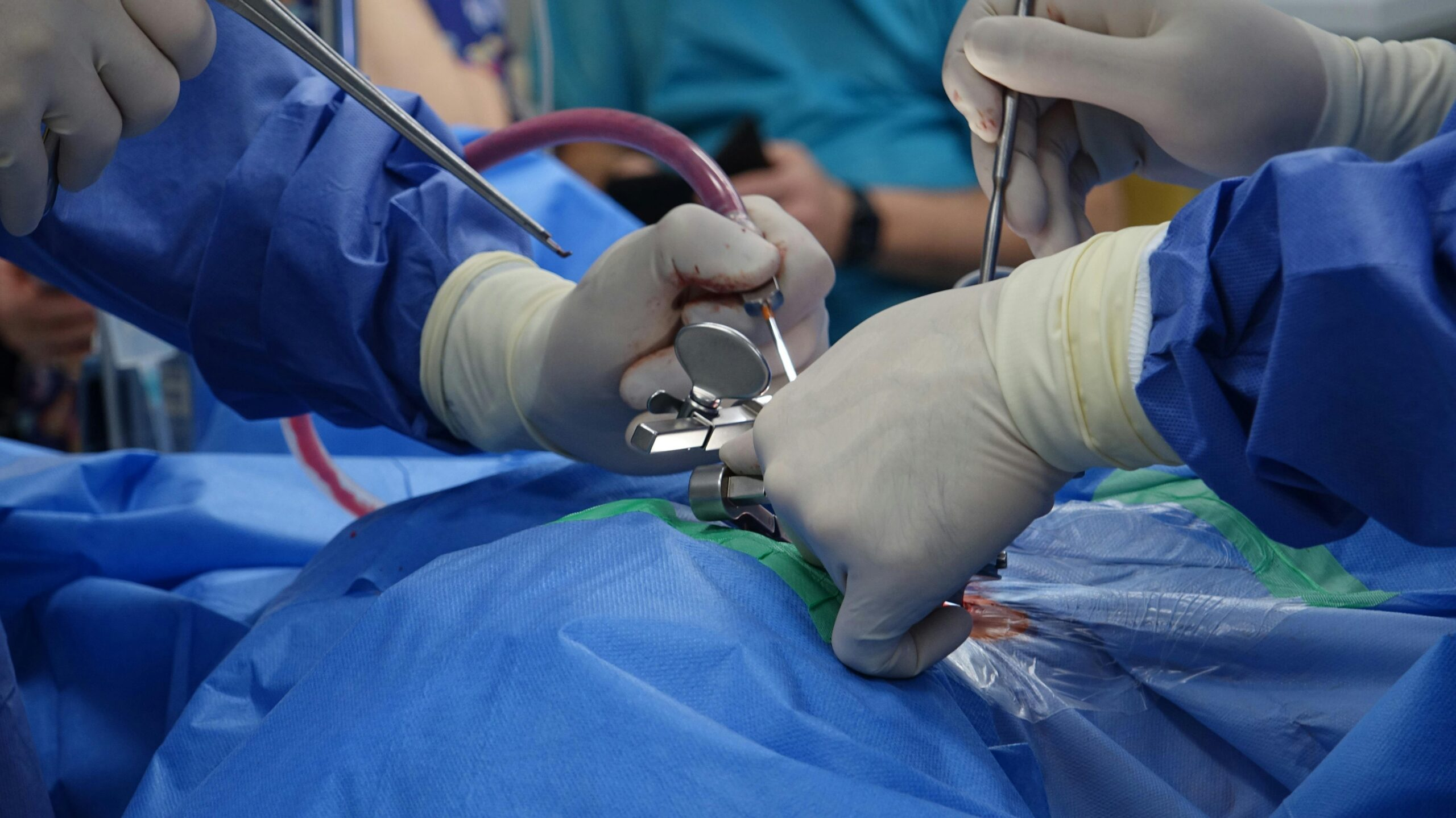 Dr. Rajesh Kapoor, gallbladder stone specialist in Noida, examining a patient