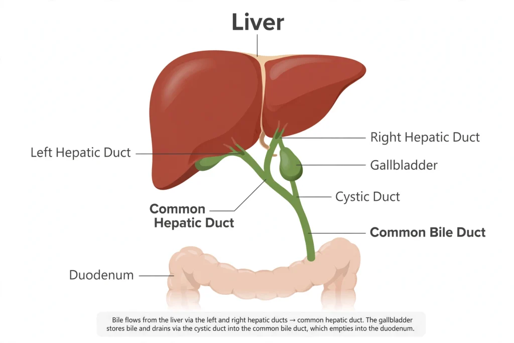 Diagram showing gallbladder location and how gallstones form